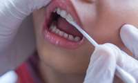 Dental Specialist: Fluoride Therapy Prevents up to 50 Percent of Tooth Decay in Children